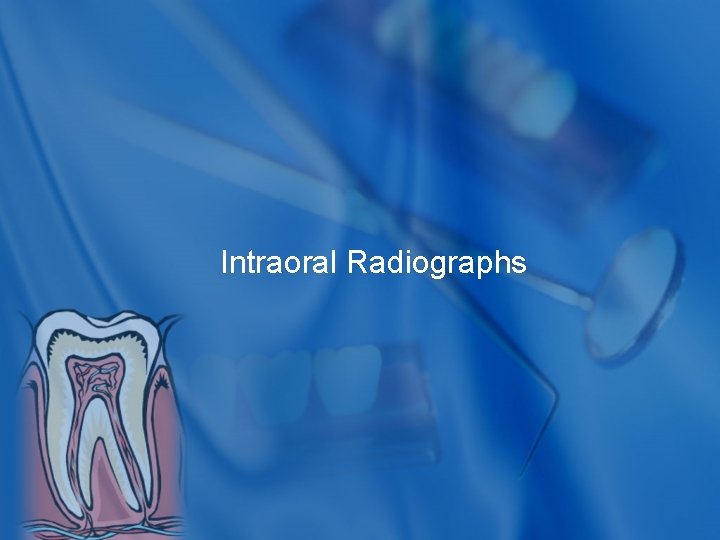 Intraoral Radiographs 