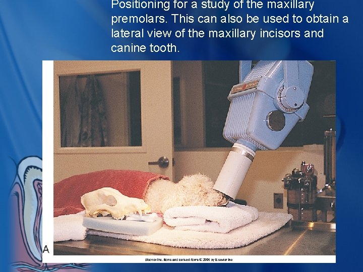 Positioning for a study of the maxillary premolars. This can also be used to