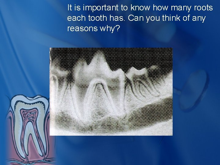 It is important to know how many roots each tooth has. Can you think