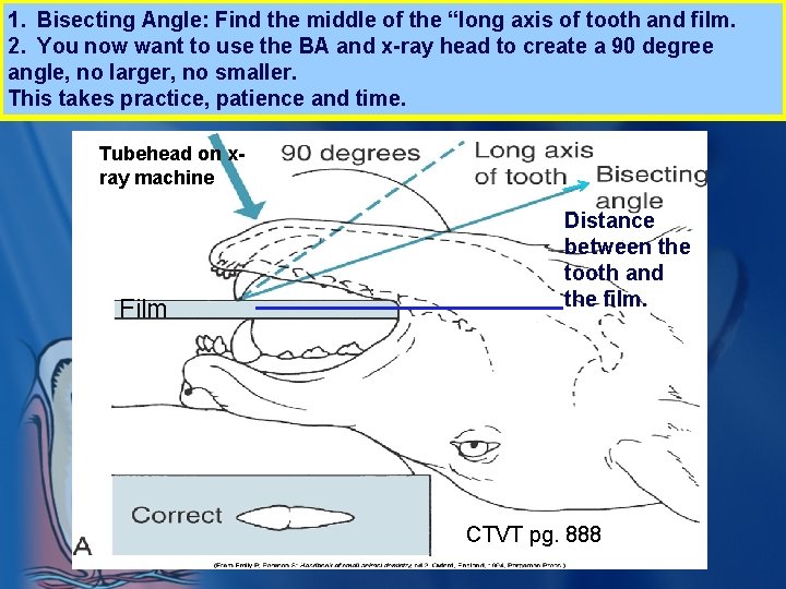 1. Bisecting Angle: Find the middle of the “long axis of tooth and film.