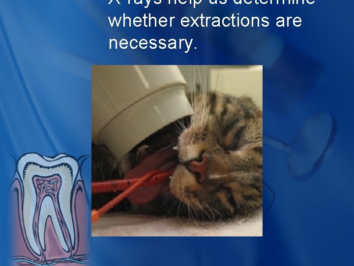 X-rays help us determine whether extractions are necessary. 