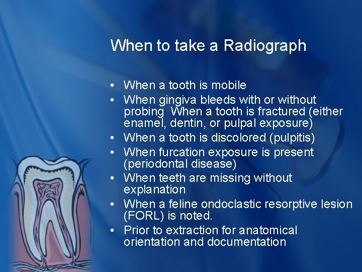 When to take a Radiograph • When a tooth is mobile • When gingiva