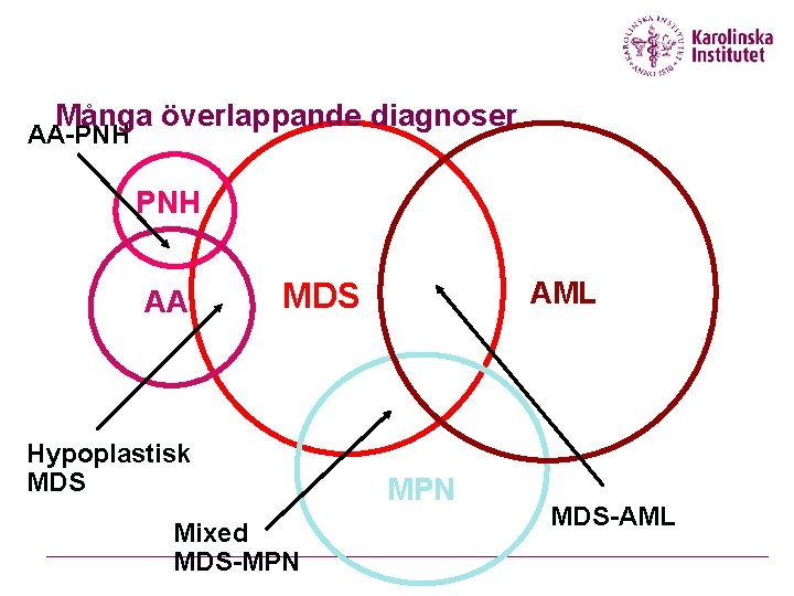 Många överlappande diagnoser AA-PNH AA MDS Hypoplastisk MDS Mixed MDS-MPN AML MPN MDS-AML 