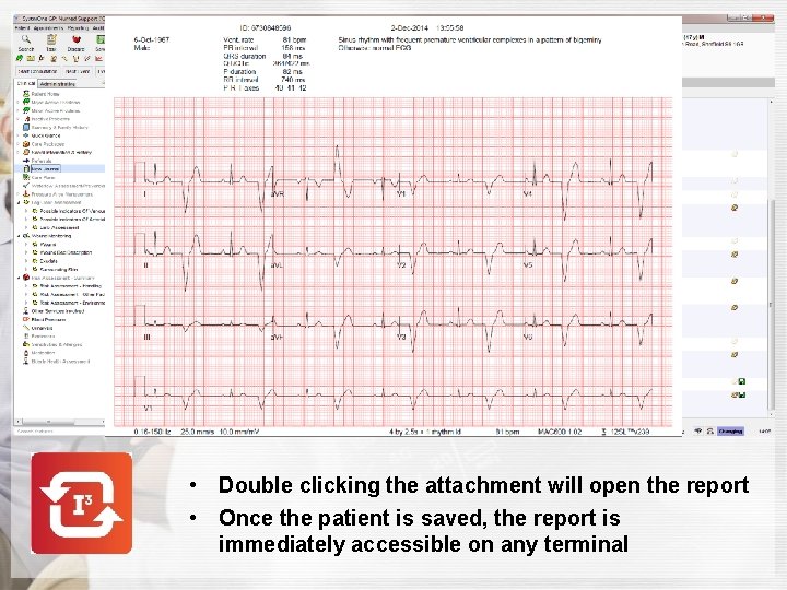  • Double clicking the attachment will open the report • Once the patient
