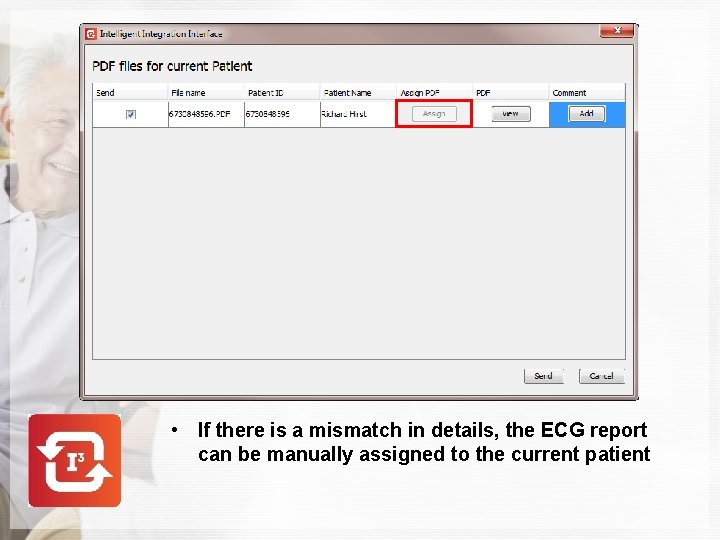  • If there is a mismatch in details, the ECG report can be