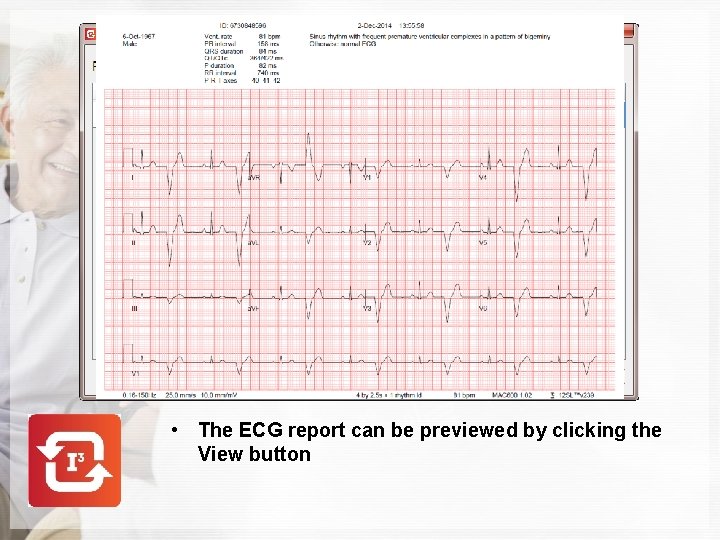  • The ECG report can be previewed by clicking the View button 