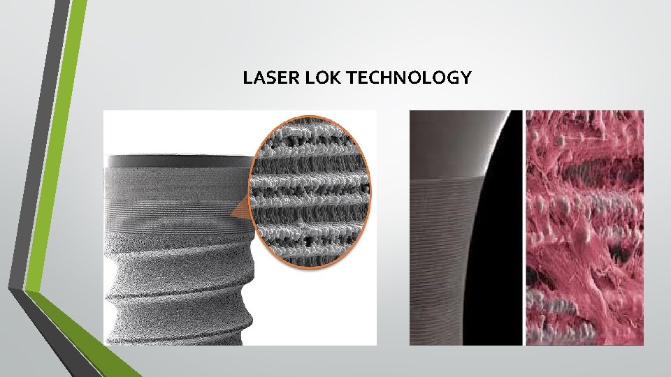 LASER LOK TECHNOLOGY 