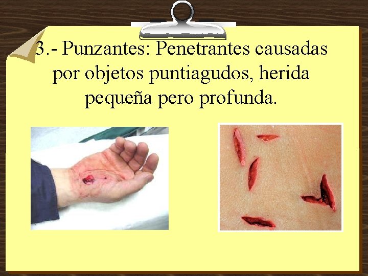 3. - Punzantes: Penetrantes causadas por objetos puntiagudos, herida pequeña pero profunda. 