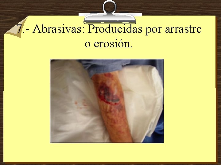 7. - Abrasivas: Producidas por arrastre o erosión. 