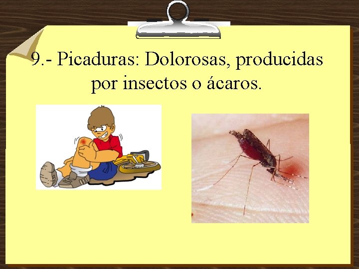 9. - Picaduras: Dolorosas, producidas por insectos o ácaros. 