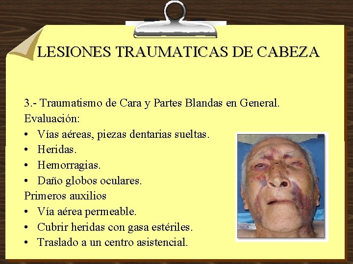 LESIONES TRAUMATICAS DE CABEZA 3. - Traumatismo de Cara y Partes Blandas en General.
