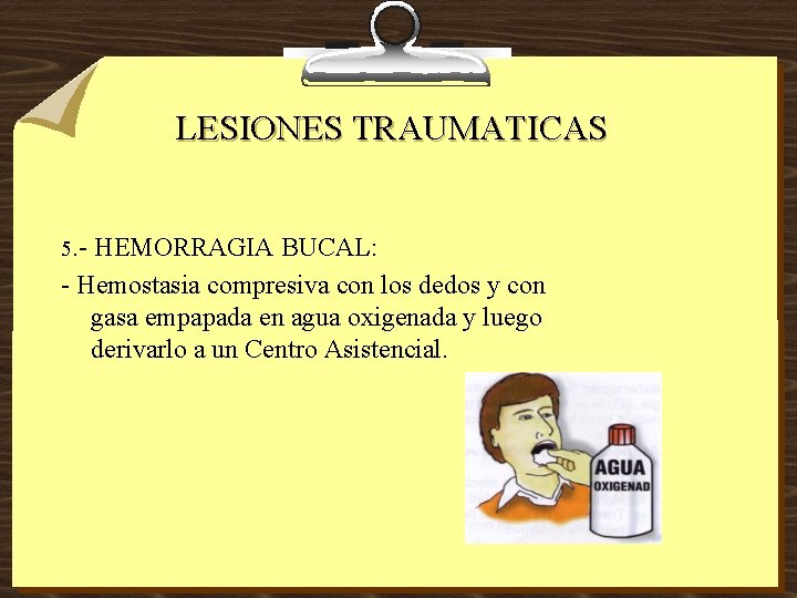 LESIONES TRAUMATICAS 5. - HEMORRAGIA BUCAL: - Hemostasia compresiva con los dedos y con