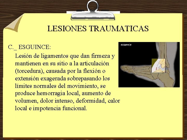 LESIONES TRAUMATICAS C. _ ESGUINCE: Lesión de ligamentos que dan firmeza y mantienen en