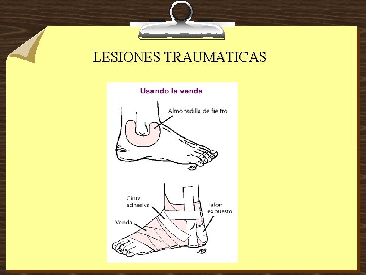 LESIONES TRAUMATICAS 