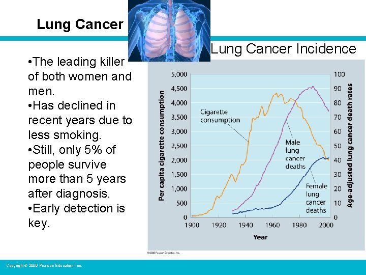 Lung Cancer • The leading killer of both women and men. • Has declined