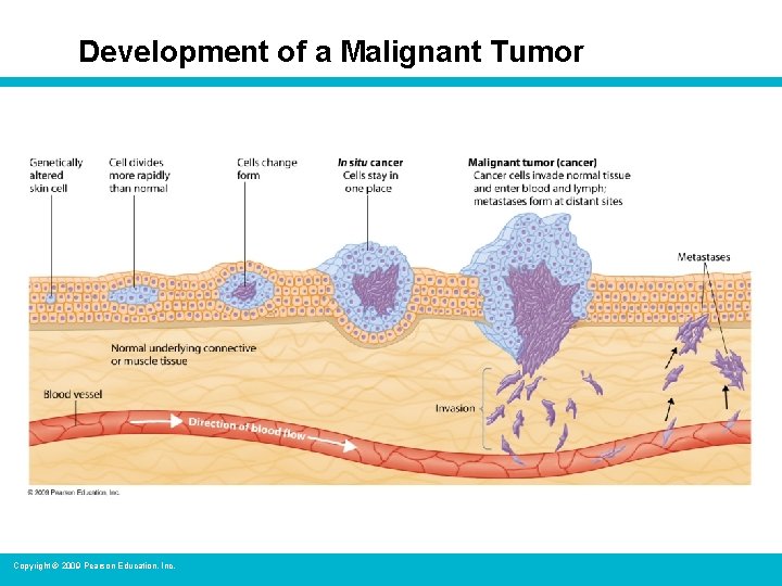 Development of a Malignant Tumor Copyright © 2009 Pearson Education, Inc. 