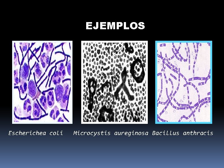 EJEMPLOS Escherichea coli Microcystis aureginosa Bacillus anthracis 