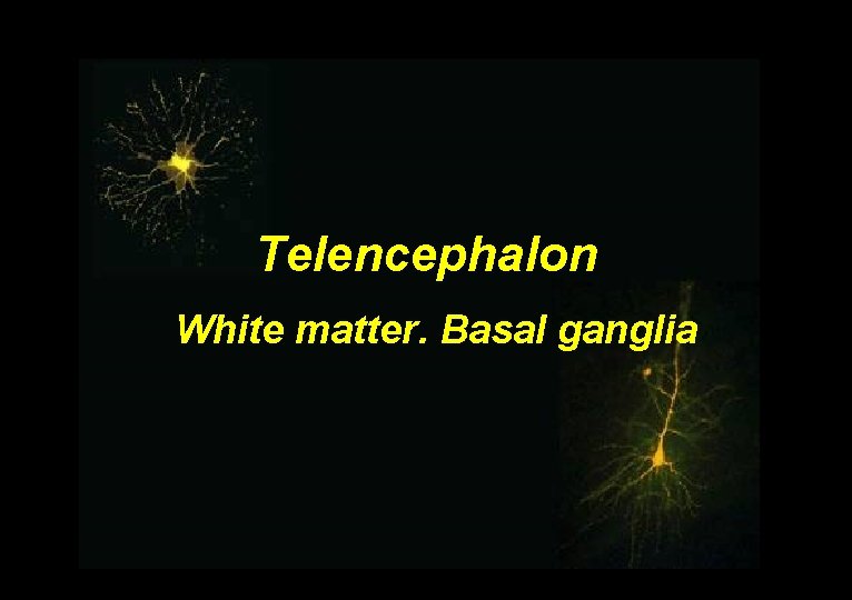 Telencephalon White matter. Basal ganglia 
