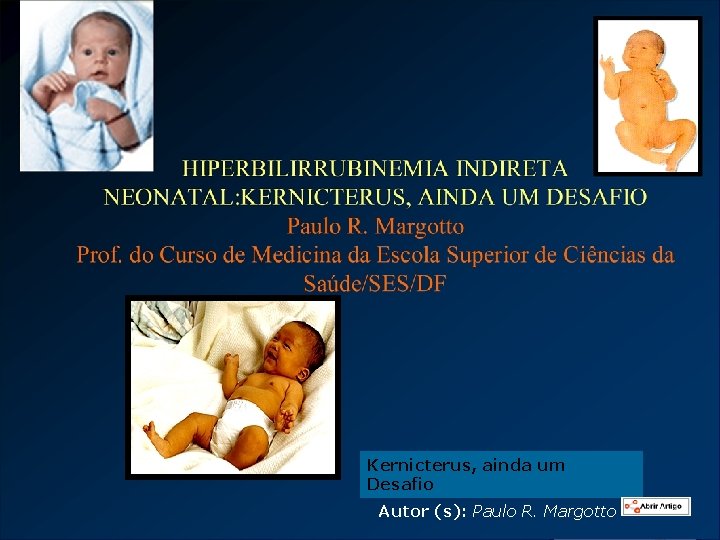 Kernicterus, ainda um Desafio Autor (s): Paulo R. Margotto 