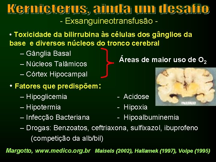 - Exsanguineotransfusão • Toxicidade da bilirrubina às células dos gânglios da base e diversos
