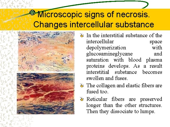 Microscopic signs of necrosis. Changes intercellular substance In the interstitial substance of the intercellular