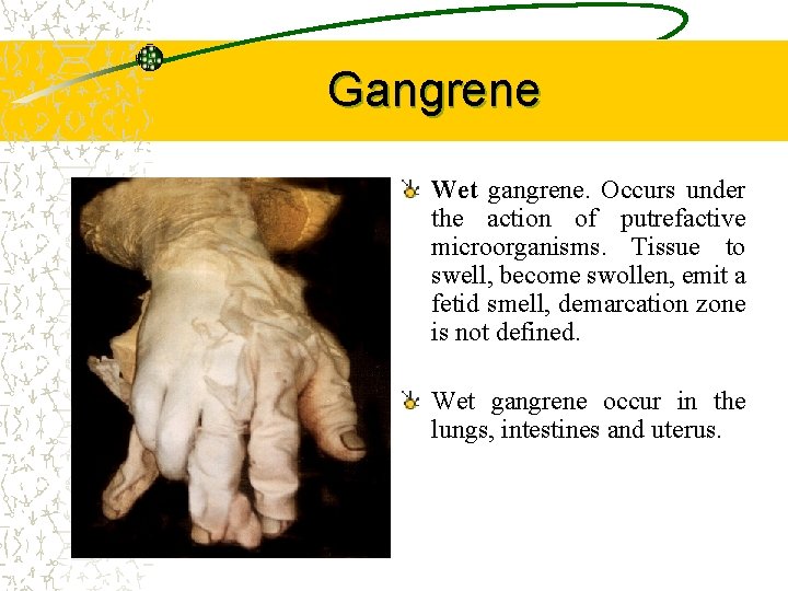 Gangrene Wet gangrene. Occurs under the action of putrefactive microorganisms. Tissue to swell, become