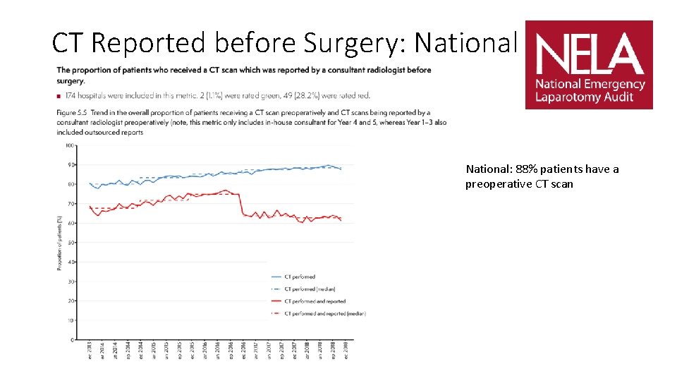 CT Reported before Surgery: National: 88% patients have a preoperative CT scan 