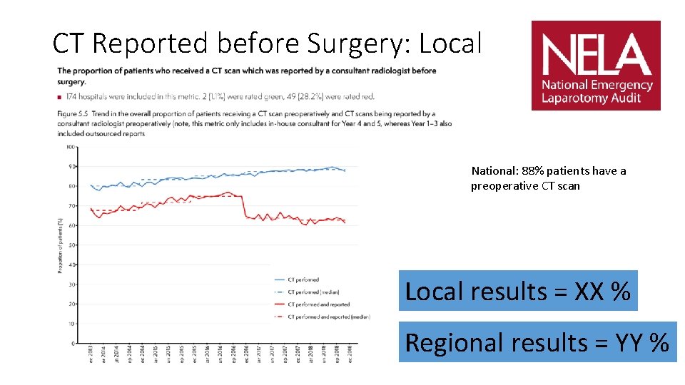 CT Reported before Surgery: Local National: 88% patients have a preoperative CT scan Local