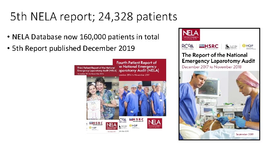 5 th NELA report; 24, 328 patients • NELA Database now 160, 000 patients