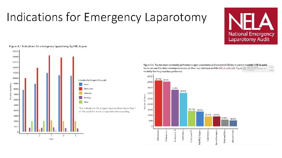 Indications for Emergency Laparotomy 