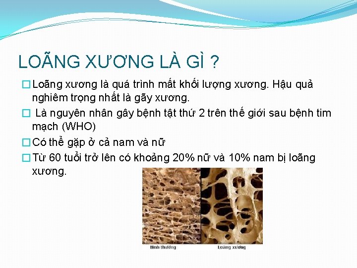 LOÃNG XƯƠNG LÀ GÌ ? �Loãng xương là quá trình mất khối lượng xương.