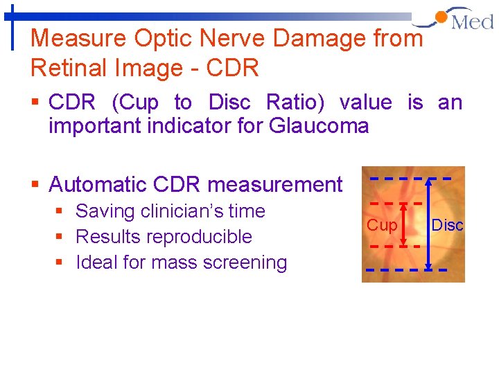Measure Optic Nerve Damage from Retinal Image - CDR § CDR (Cup to Disc