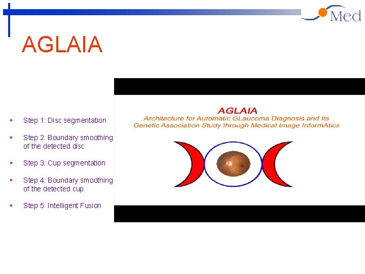 AGLAIA § Step 1: Disc segmentation § Step 2: Boundary smoothing of the detected