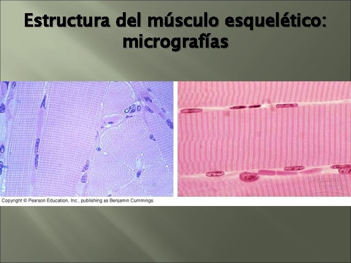 Estructura del músculo esquelético: micrografías Estructura del músculo esquelético: micrografías