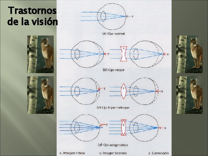 Trastornos de la visión Trastornos de la visión