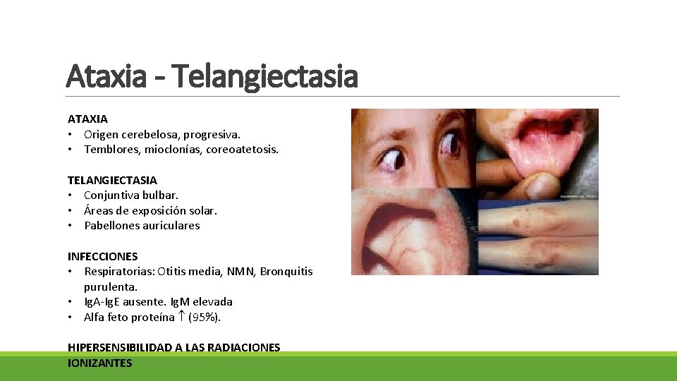 Ataxia - Telangiectasia ATAXIA • Origen cerebelosa, progresiva. • Temblores, mioclonías, coreoatetosis. TELANGIECTASIA •