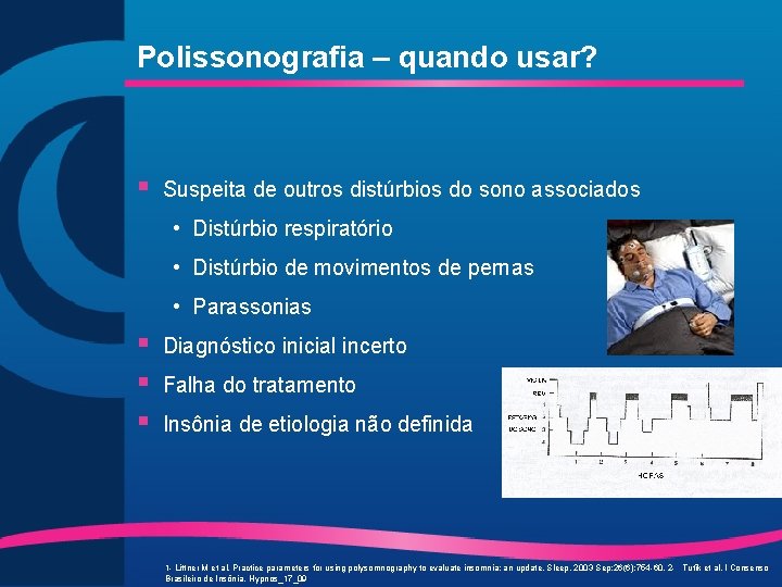 Polissonografia – quando usar? § Suspeita de outros distúrbios do sono associados • Distúrbio