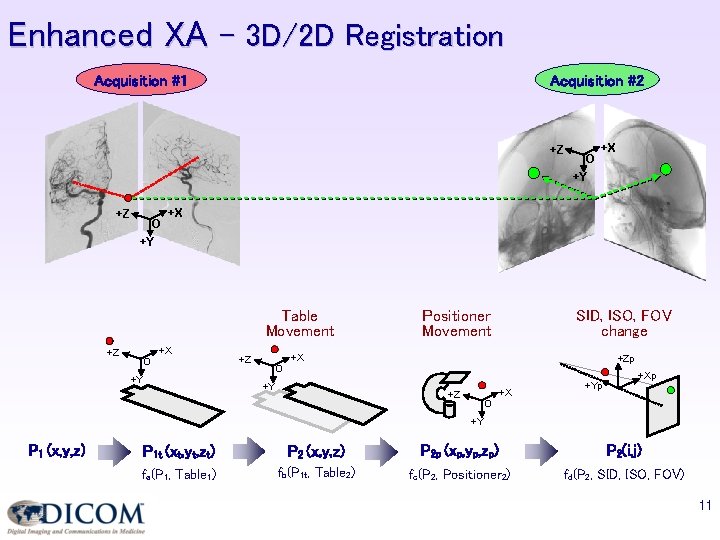Enhanced XA – 3 D/2 D Registration Acquisition #1 Acquisition #2 +Z O +X