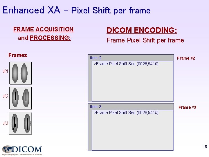 Enhanced XA – Pixel Shift per frame FRAME ACQUISITION and PROCESSING: Frames DICOM ENCODING: