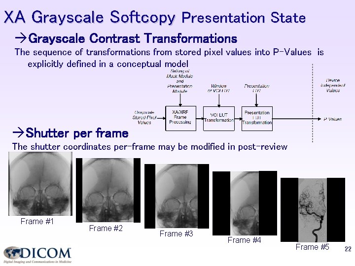 XA Grayscale Softcopy Presentation State Grayscale Contrast Transformations The sequence of transformations from stored