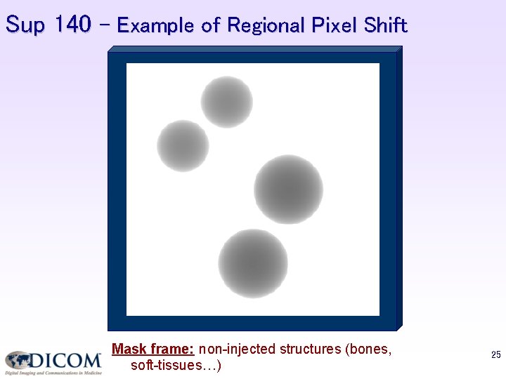Sup 140 – Example of Regional Pixel Shift Mask frame: non-injected structures (bones, soft-tissues…)