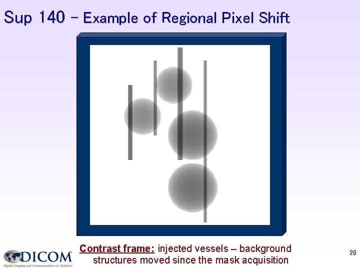 Sup 140 – Example of Regional Pixel Shift Contrast frame: injected vessels – background