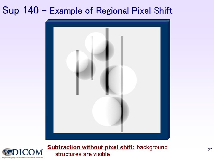 Sup 140 – Example of Regional Pixel Shift Subtraction without pixel shift: background structures