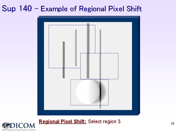 Sup 140 – Example of Regional Pixel Shift: Select region 3 35 