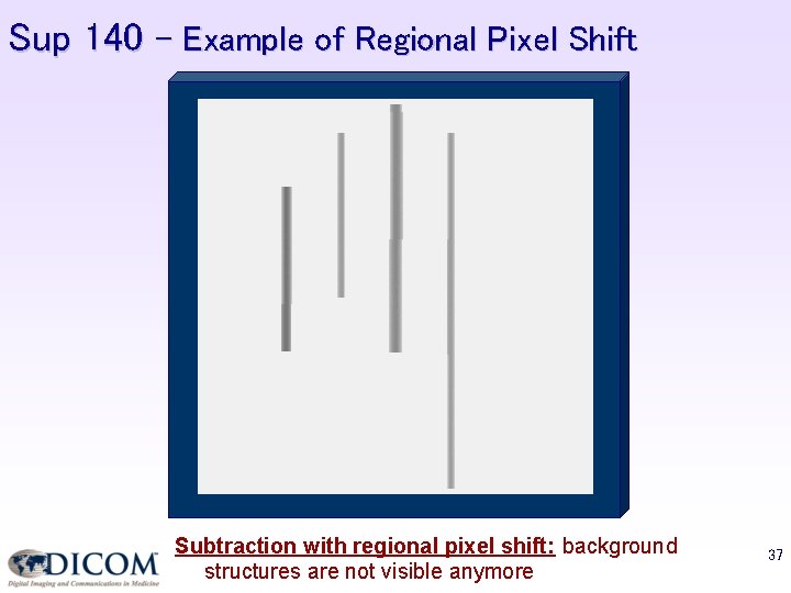 Sup 140 – Example of Regional Pixel Shift Subtraction with regional pixel shift: background