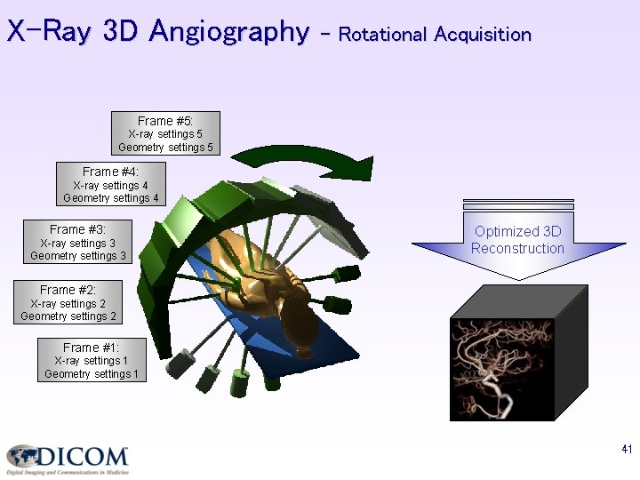 X-Ray 3 D Angiography – Rotational Acquisition Frame #5: X-ray settings 5 Geometry settings