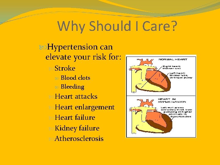 Why Should I Care? Hypertension can elevate your risk for: Stroke Blood clots Bleeding