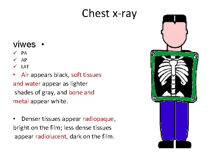 Chest x-ray viwes • ü PA ü AP ü LAT • Air appears black,