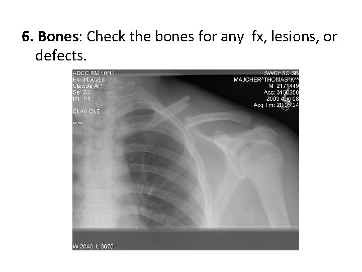 6. Bones: Check the bones for any fx, lesions, or defects. 