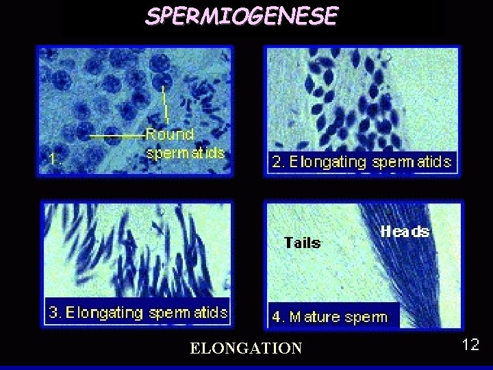 SPERMIOGENESE ELONGATION 